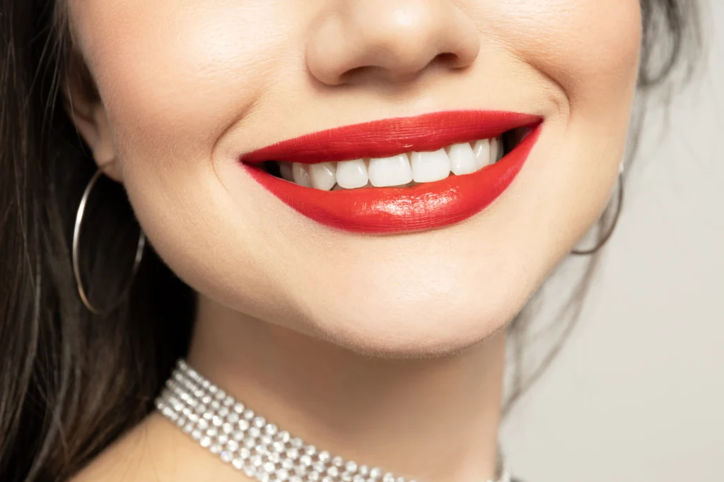 A close-up of bright, evenly shaped teeth and bold red lipstick, illustrating the results typically achieved through Hollywood Smile Treatment in Dubai.